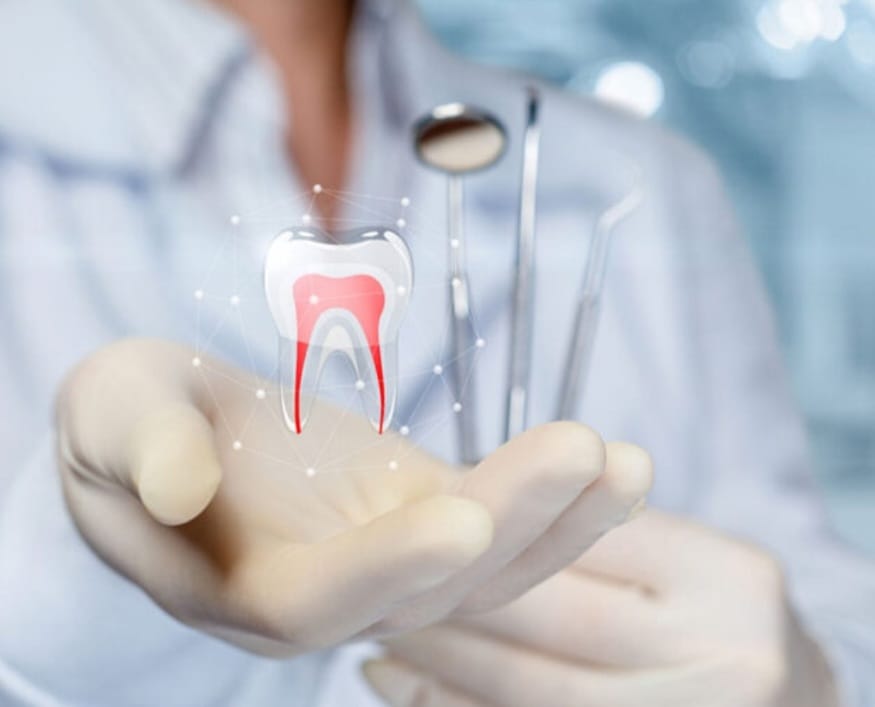 દાંતની મૂળિયા સુધી સફાઈ અને સારવાર ROOT CANAL TREATMENT