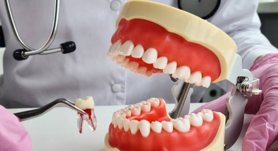 DENTAL EXTRACTION/TOOTH REMOVALદાંત કાઢવાની પ્રક્રિયા 