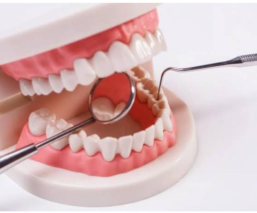 FULL MOUTH REHEBILITATION/COMPLETE SOLUTION OF ALL TEETH