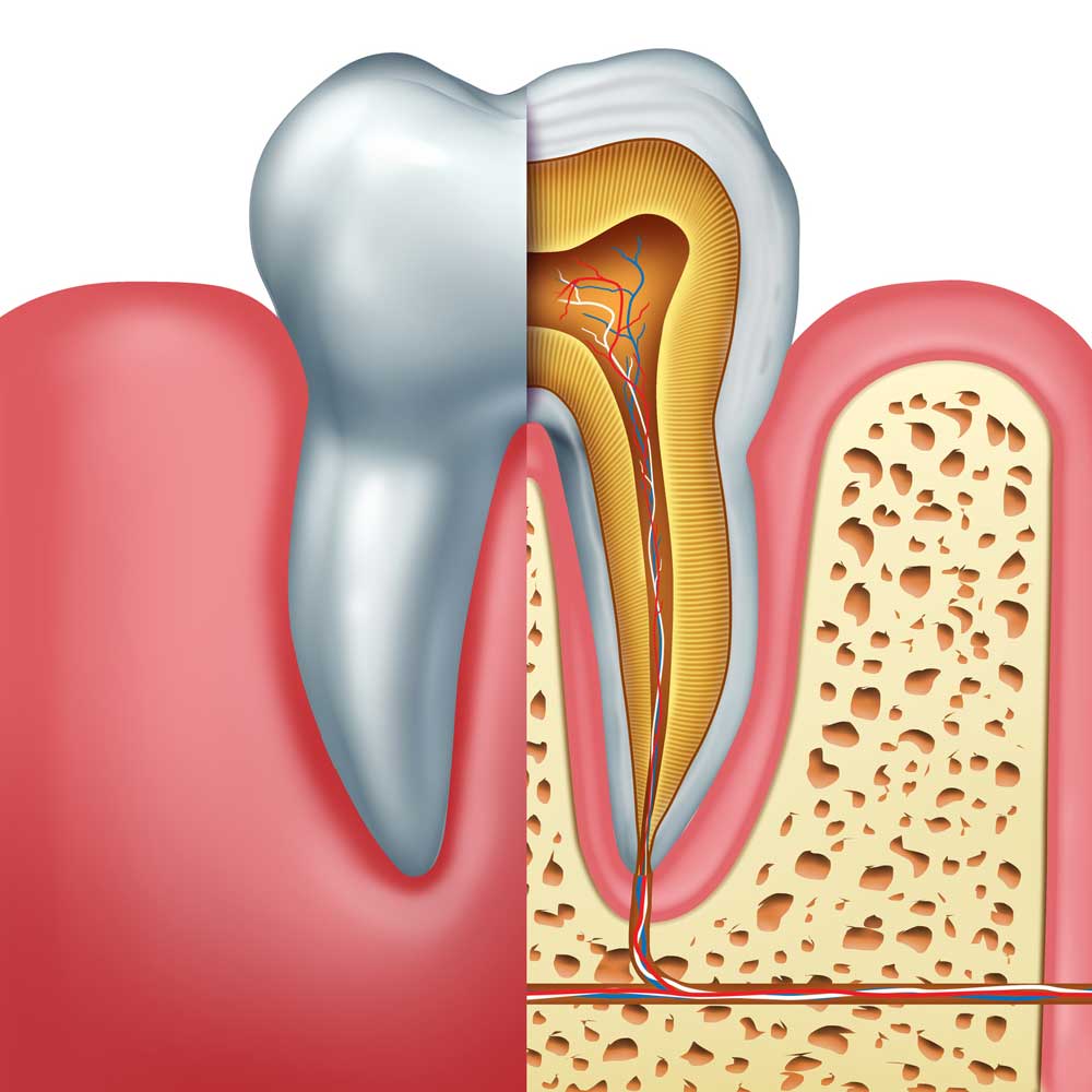 Root Canal Treatment