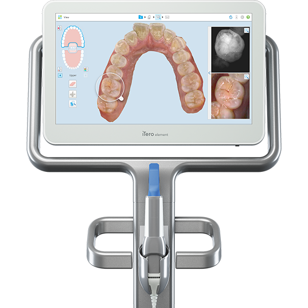 Digital Intra Oral Scanner